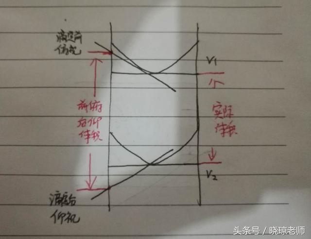 高中化学之酸碱中和滴定仰视俯视误差问题解析